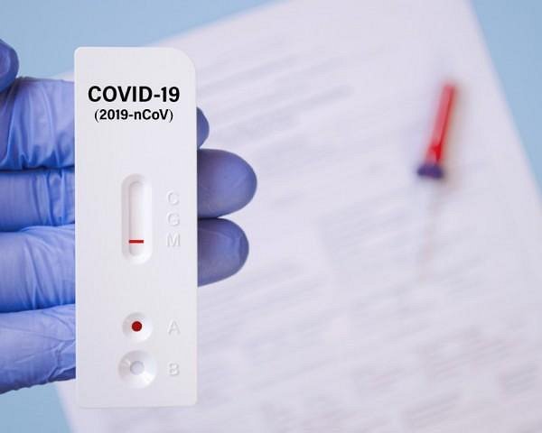 COVID-19 hitri antigenski testi